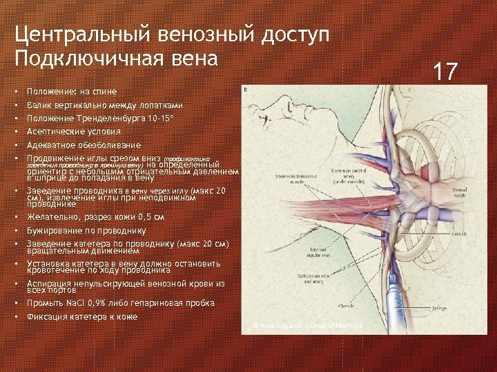 Рисунок подключичной вены