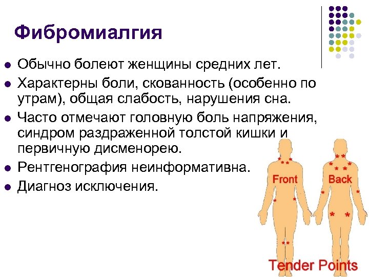 Фибромиалгия l l l Обычно болеют женщины средних лет. Характерны боли, скованность (особенно по