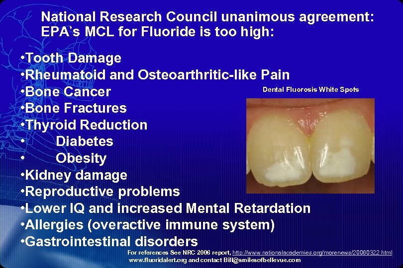 National Research Council unanimous agreement: EPA’s MCL for Fluoride is too high: • Tooth