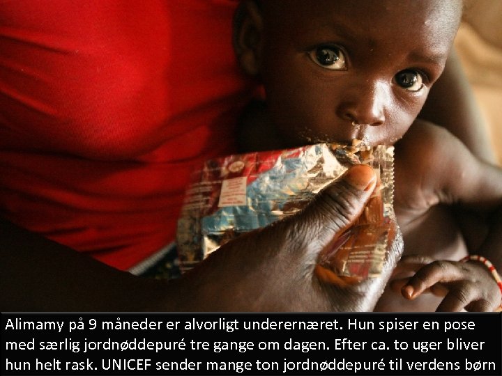 Alimamy på 9 måneder er alvorligt underernæret. Hun spiser en pose med særlig jordnøddepuré