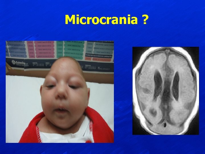 Microcrania ? 