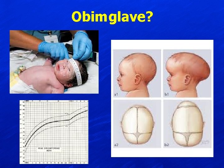 Obim glave? 