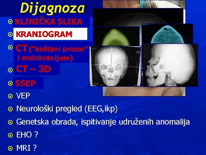 Dijagnoza ¤ KLINIČKA SLIKA ¤ KRANIOGRAM ¤ CT (“koštani prozor” endokranijum) ii endokranijum) ¤