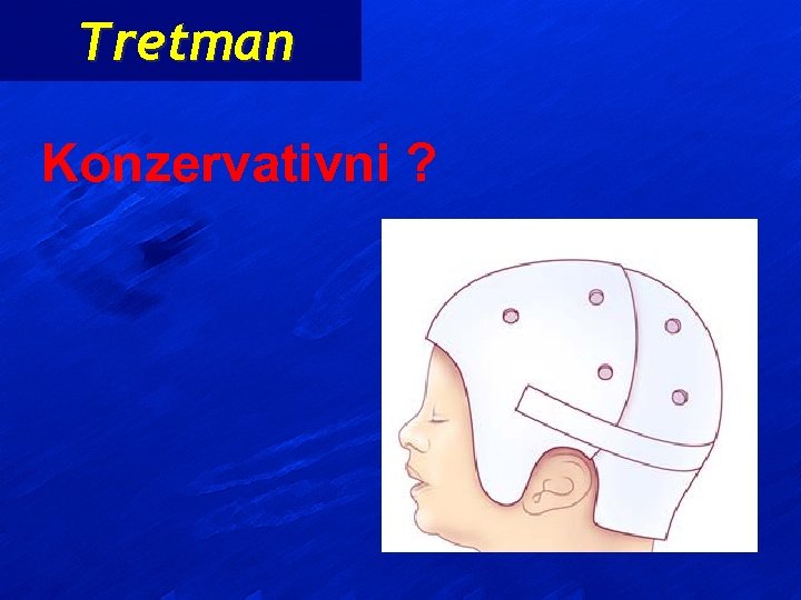 Tretman Konzervativni ? 