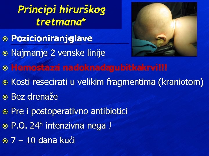 Principi hirurškog tretmana* ¤ Pozicioniranje glave ¤ Najmanje 2 venske linije ¤ Hemostaza nadoknada