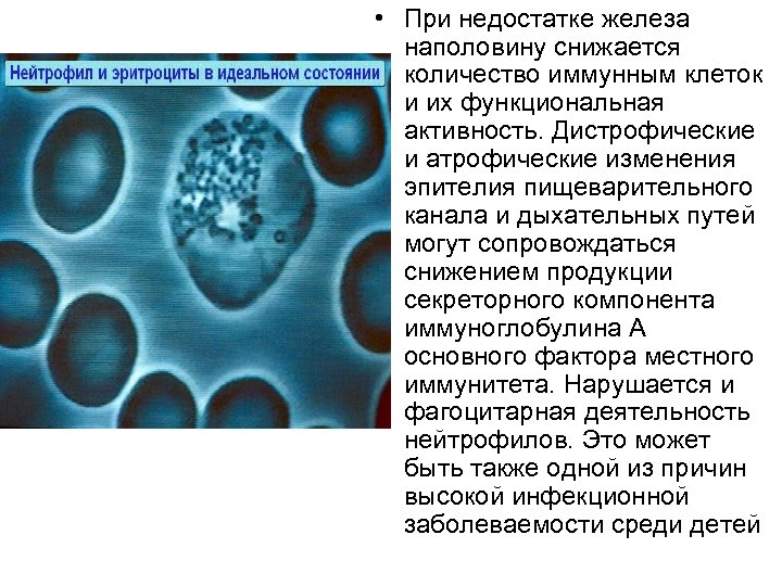  • При недостатке железа наполовину снижается количество иммунным клеток и их функциональная активность.