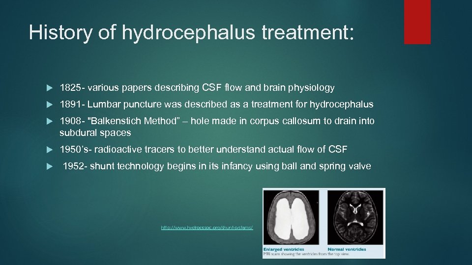 History of hydrocephalus treatment: 1825 - various papers describing CSF flow and brain physiology