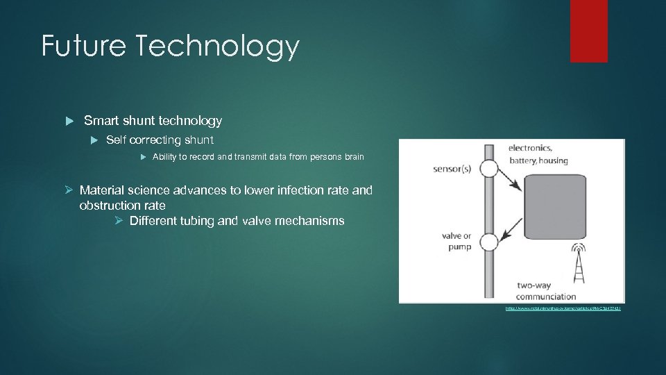 Future Technology Smart shunt technology Self correcting shunt Ability to record and transmit data