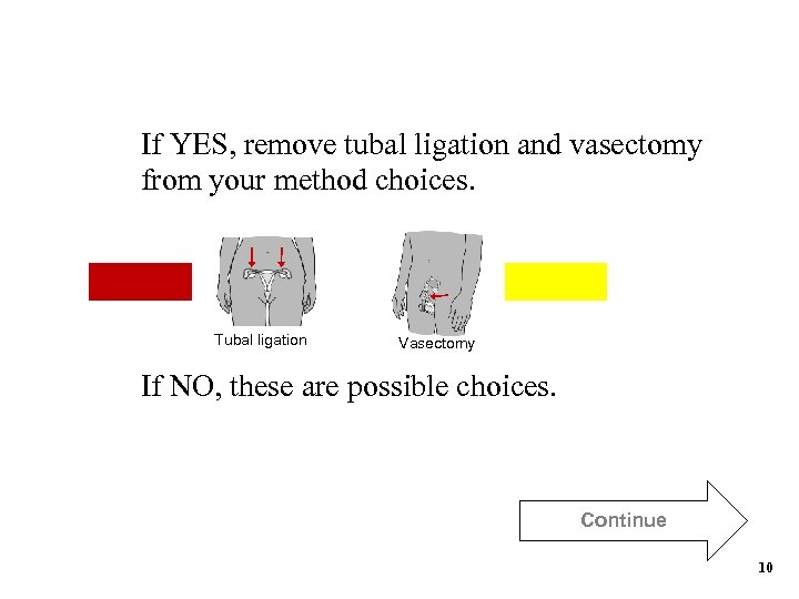 If YES, remove tubal ligation and vasectomy from your method choices. Tubal ligation Vasectomy