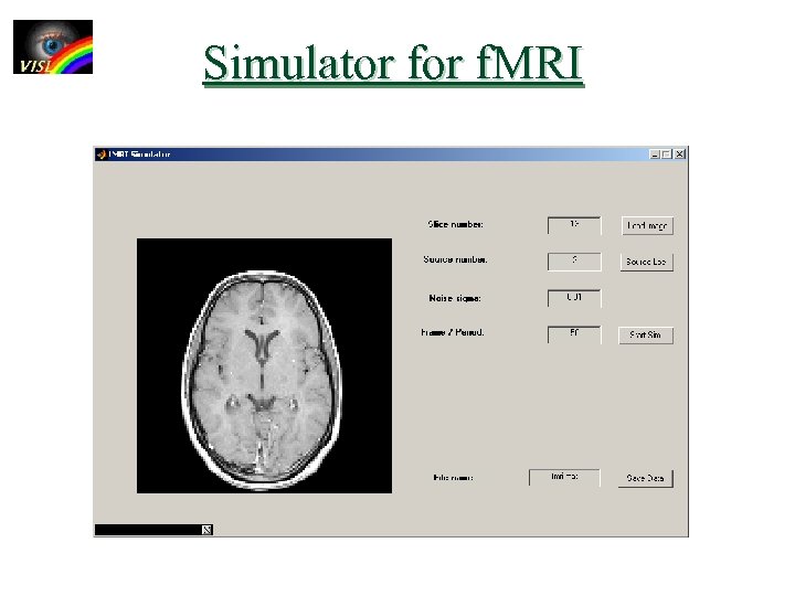 Simulator f. MRI 