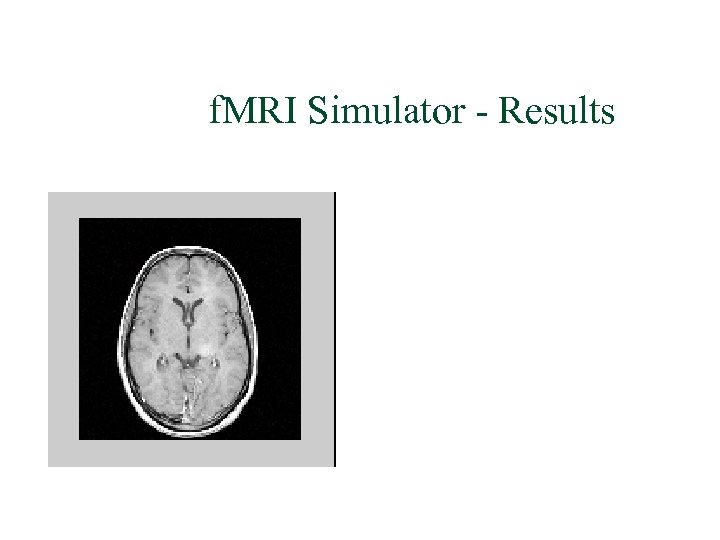 f. MRI Simulator - Results 
