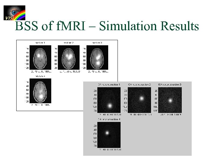 BSS of f. MRI – Simulation Results 