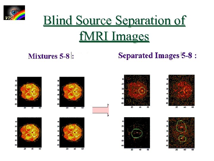 Blind Source Separation of f. MRI Images 