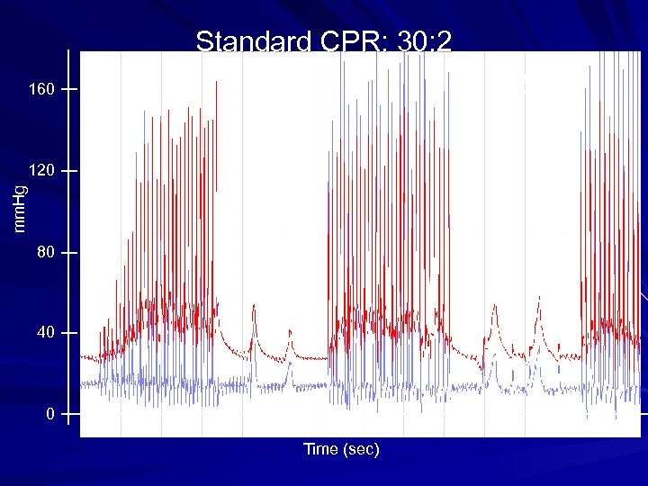 Standard CPR: 30: 2 5 sec 160 mm. Hg 120 80 40 0 Time