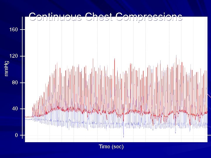 Continuous Chest Compressions 160 5 sec mm. Hg 120 80 40 0 Time (sec)