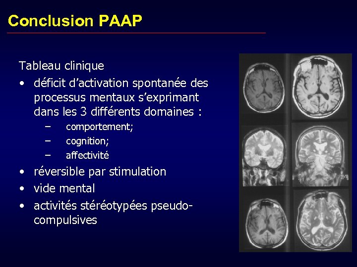 Conclusion PAAP Tableau clinique • déficit d’activation spontanée des processus mentaux s’exprimant dans les