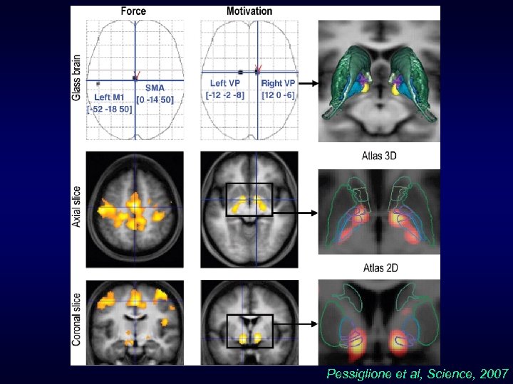 Pessiglione et al, Science, 2007 