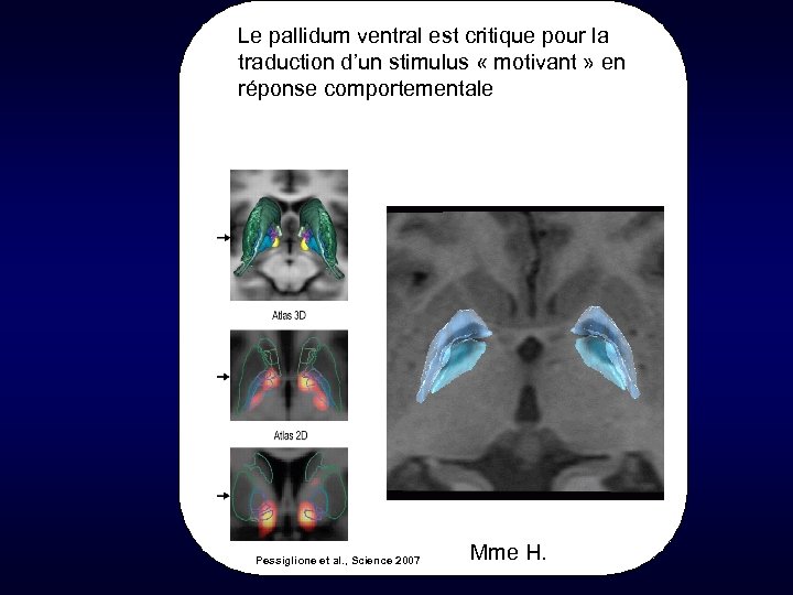 Le pallidum ventral est critique pour la traduction d’un stimulus « motivant » en