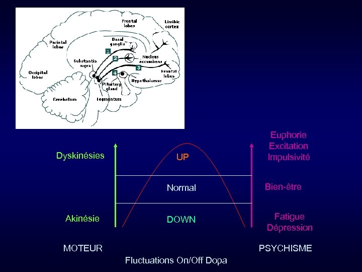 Dyskinésies UP Euphorie Excitation Impulsivité Normal Akinésie Bien-être DOWN Fatigue Dépression MOTEUR PSYCHISME Fluctuations