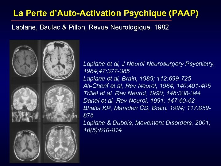 La Perte d’Auto-Activation Psychique (PAAP) Laplane, Baulac & Pillon, Revue Neurologique, 1982 Laplane et