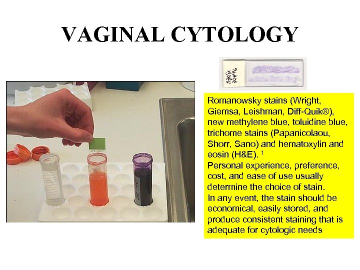 VAGINAL CYTOLOGY Romanowsky stains (Wright, Giemsa, Leishman, Diff-Quik®), new methylene blue, toluidine blue, trichome