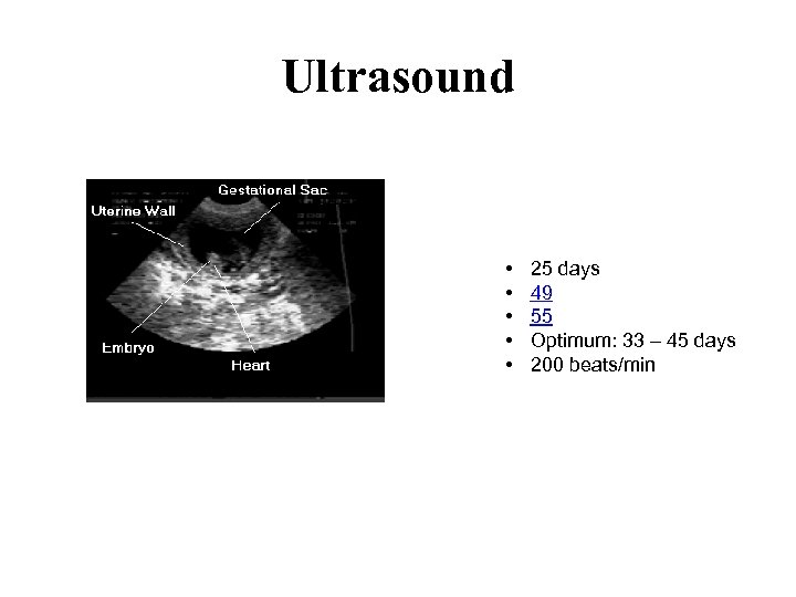 Ultrasound • • • 25 days 49 55 Optimum: 33 – 45 days 200