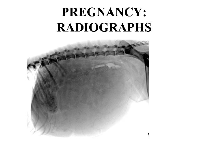 PREGNANCY: RADIOGRAPHS 