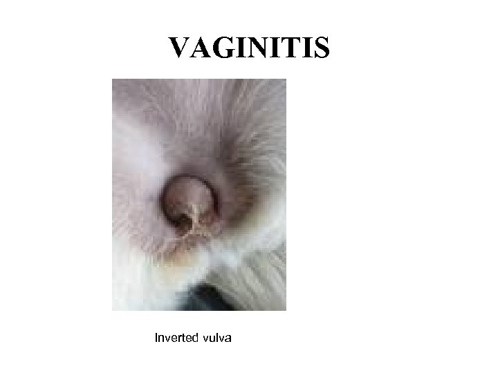 VAGINITIS Inverted vulva 