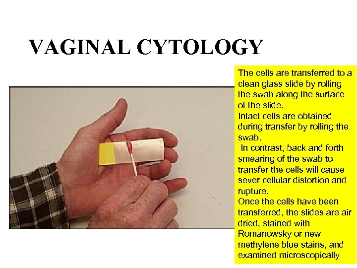 VAGINAL CYTOLOGY The cells are transferred to a clean glass slide by rolling the