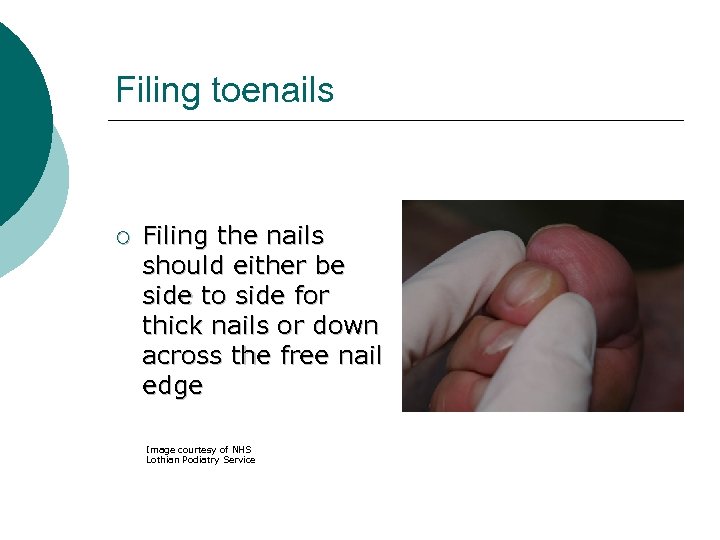 Filing toenails ¡ Filing the nails should either be side to side for thick