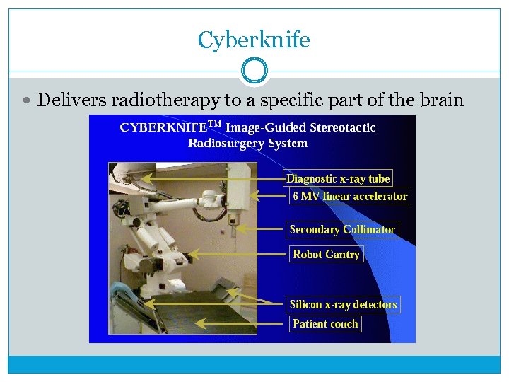 Cyberknife Delivers radiotherapy to a specific part of the brain 