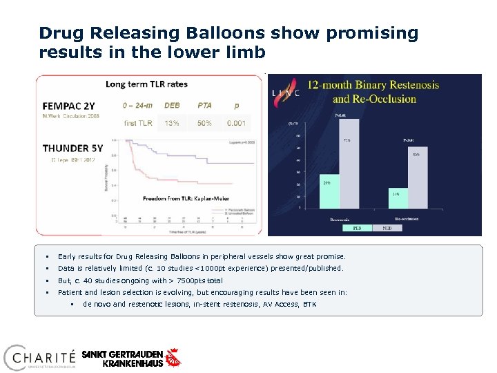 Drug Releasing Balloons show promising results in the lower limb § Early results for