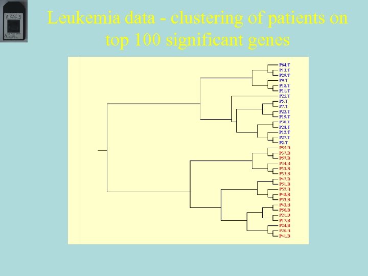 Leukemia data - clustering of patients on top 100 significant genes 