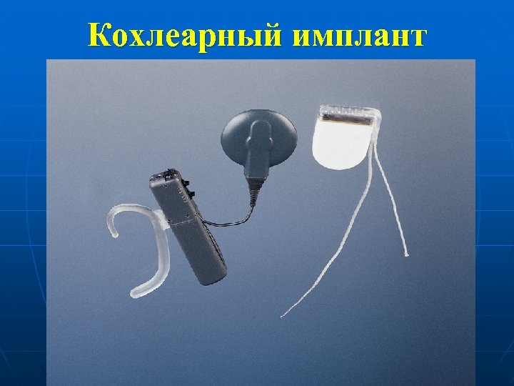 Кохлеарный имплант 