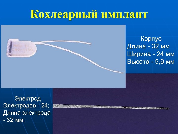 Кохлеарный имплант Корпус Длина - 32 мм Ширина - 24 мм Высота - 5,