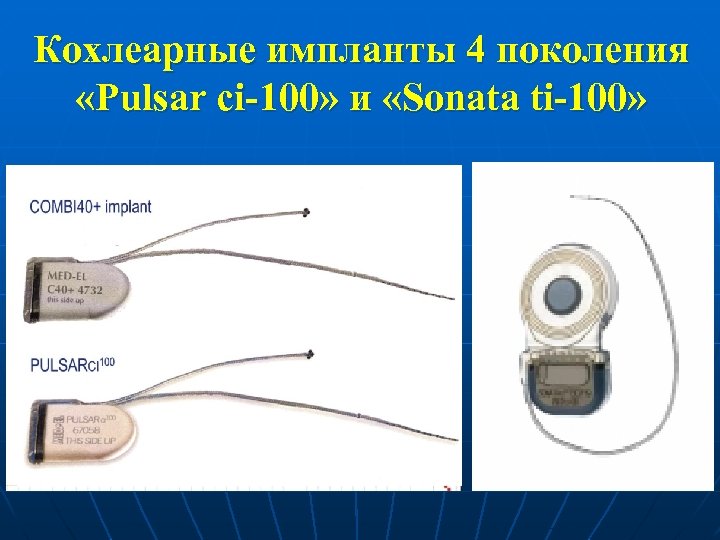Кохлеарные импланты 4 поколения «Pulsar ci-100» и «Sonata ti-100» 