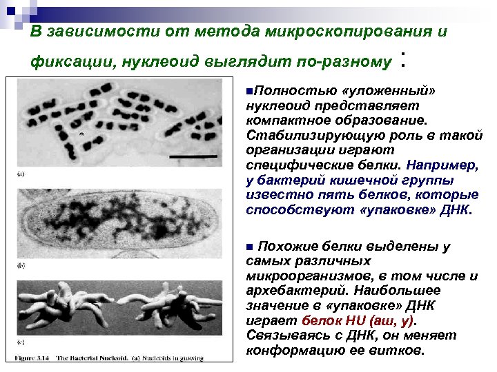 В зависимости от метода микроскопирования и фиксации, нуклеоид выглядит по-разному : n. Полностью «уложенный»