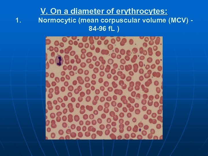 V. On a diameter of erythrocytes: 1. Normocytic (mean corpuscular volume (MCV) 84 -96