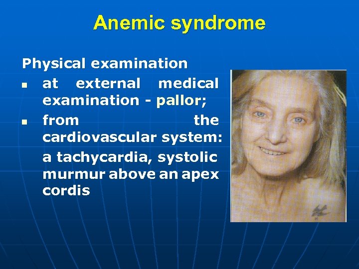 Anemic syndrome Physical examination n at external medical examination - pallor; n from the