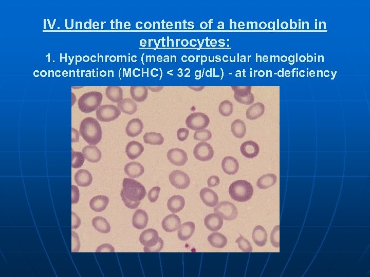 IV. Under the contents of a hemoglobin in erythrocytes: 1. Hypochromic (mean corpuscular hemoglobin