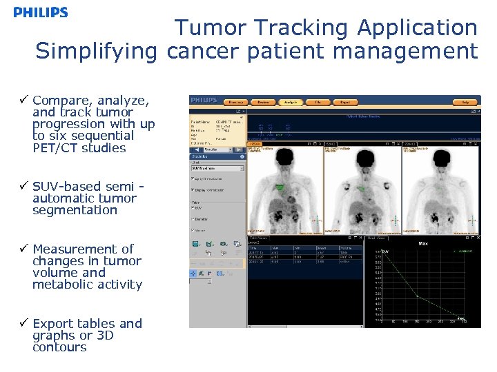 Tumor Tracking Application Simplifying cancer patient management ü Compare, analyze, and track tumor progression
