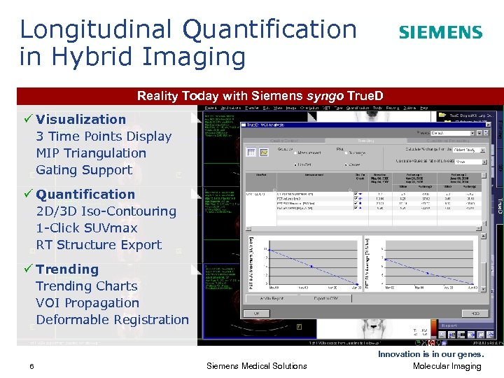 Longitudinal Quantification in Hybrid Imaging Reality Today with Siemens syngo True. D ü Visualization