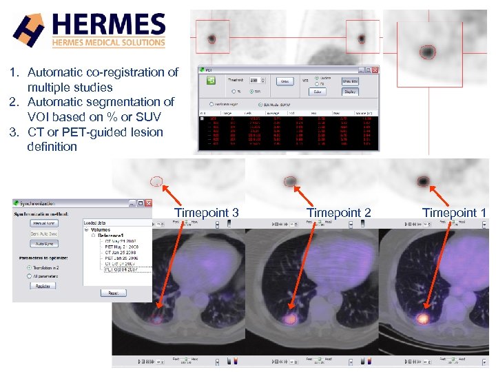 1. Automatic co-registration of multiple studies 2. Automatic segmentation of VOI based on %