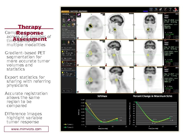 Therapy Compare tumors Response across any number of Assessment time points for multiple modalities