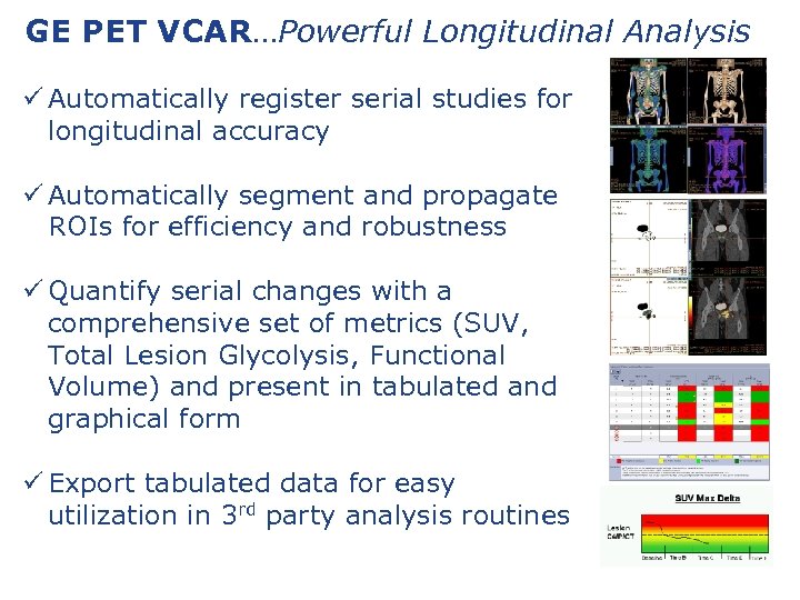 GE PET VCAR…Powerful Longitudinal Analysis ü Automatically register serial studies for longitudinal accuracy ü