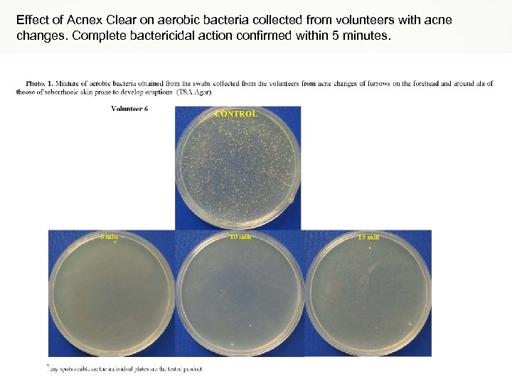 Effect of Acnex Clear on aerobic bacteria collected from volunteers with acne changes. Complete