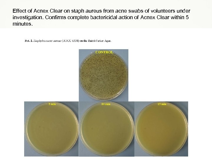 Effect of Acnex Clear on staph aureus from acne swabs of volunteers under investigation.