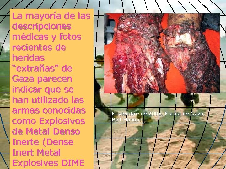 La mayoría de las descripciones médicas y fotos recientes de heridas “extrañas” de Gaza