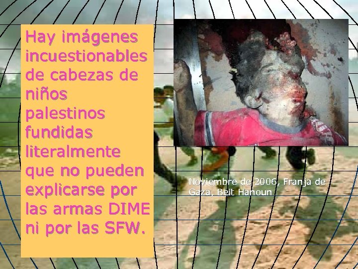 Hay imágenes incuestionables de cabezas de niños palestinos fundidas literalmente que no pueden explicarse