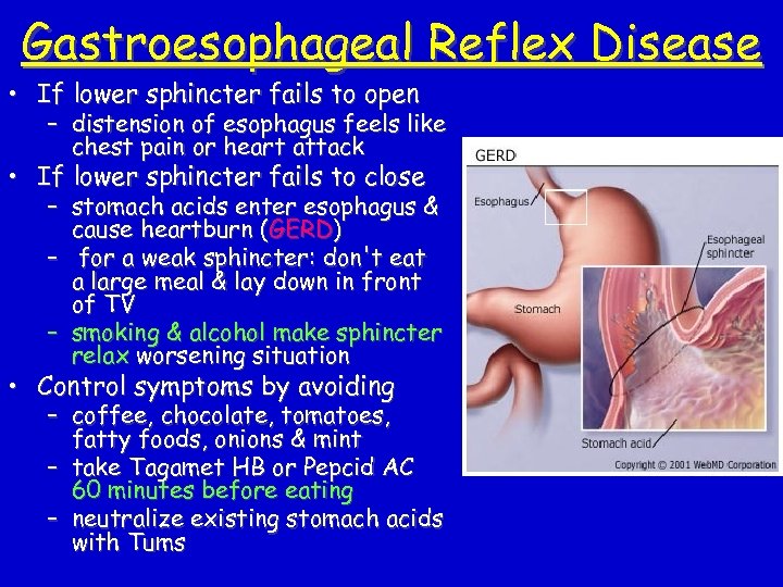 Gastroesophageal Reflex Disease • If lower sphincter fails to open – distension of esophagus